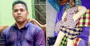 ইউটিউব দেখে অকটেন তৈরি চেষ্টা, বিস্ফোরণে ব্যবসায়ীর মৃত্যু!