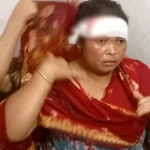 কিস্তির টাকা না পাওয়ায় গ্রাহকের মাথা ফাটালেন ব্র্যাককর্মী!