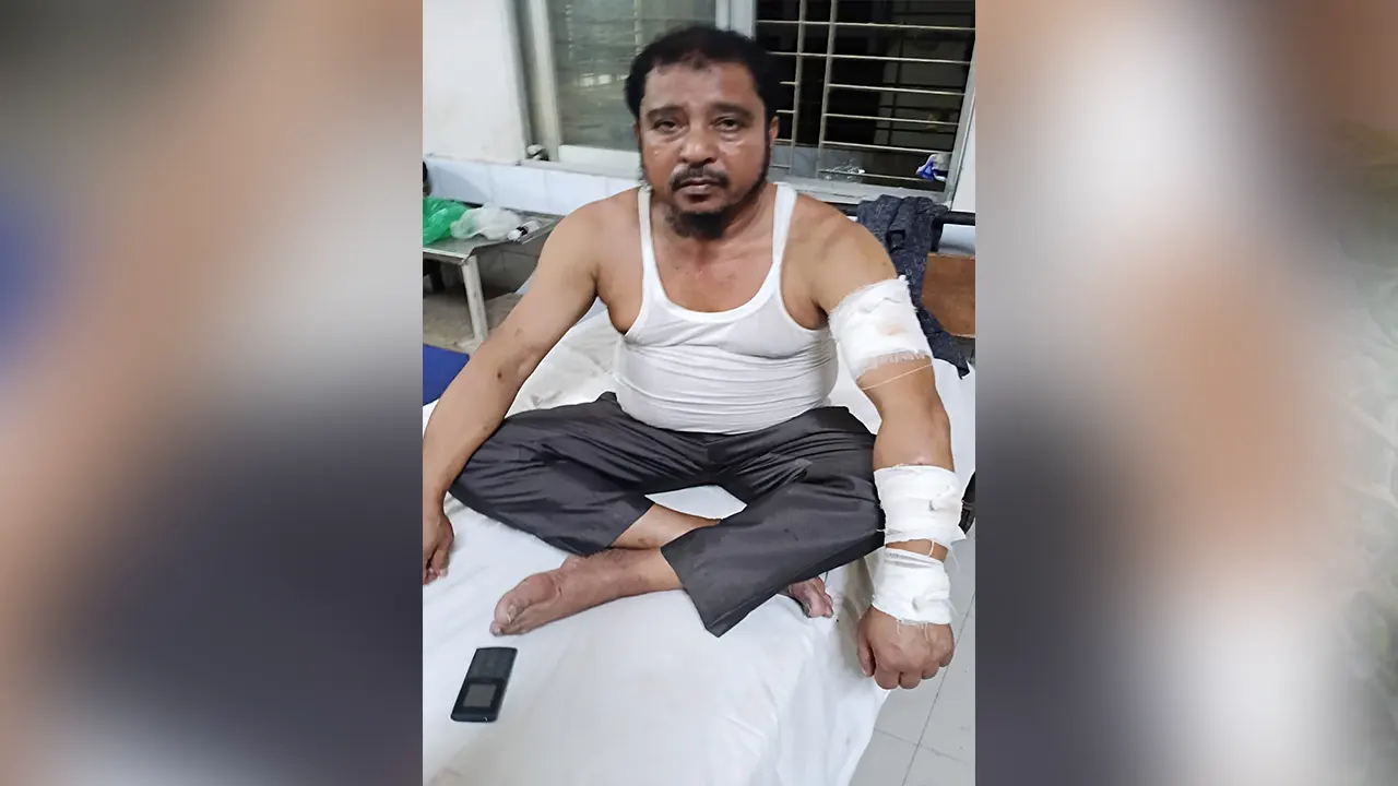 চাঁদা না পেয়ে কৃষক দল নেতাকে কুপিয়ে জখম