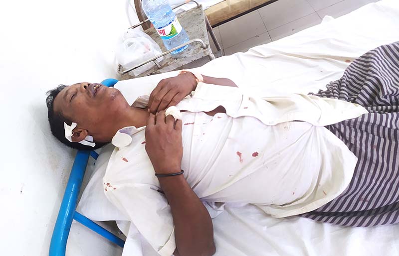 বেলকুচিতে রাজনৈতিক তর্কের জেরে হামলায় প্রতিবন্ধী আহত