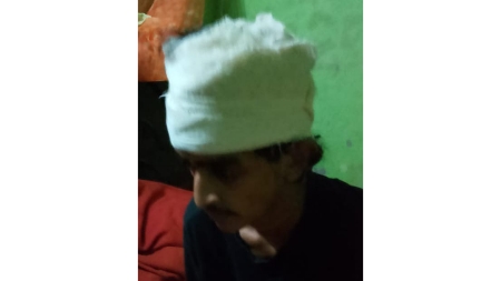 ঈদের সকালে দোকানির মারধরে রক্তাক্ত গ্রাহক, মাথায় ৭টি সেলাই!