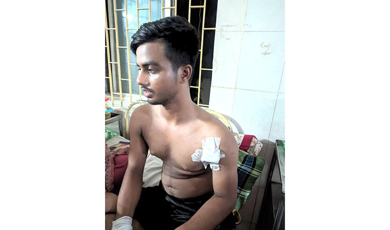 ভেড়ামারায় কিশোর গুলিবিদ্ধ