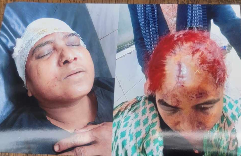 মনোহরদীতে জমি দখলের চেষ্টায় সাংবাদিক পরিবারের উপর হামলা, আহত ৩