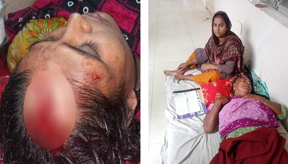 বাবার সম্পত্তি ভাগ চাইতে গিয়ে ভাইদের হাতে রক্তাক্ত জখম বড় বোন