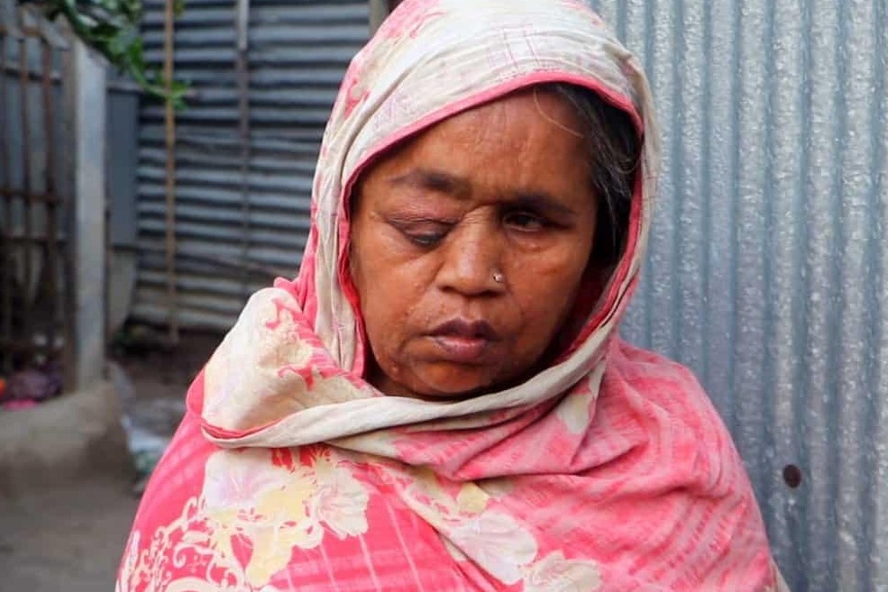 কুষ্টিয়ায় অন্ধ সাজেদার মানবেতর জীবন: দুমুঠো অন্নের জন্য এক অন্ধ মায়ের হাহাকার