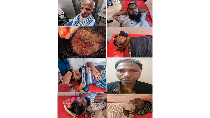 শ্রীপুরে প্রবাসীর কাছে চাঁদা না পেয়ে কুপিয়ে ৯ জনকে জখম