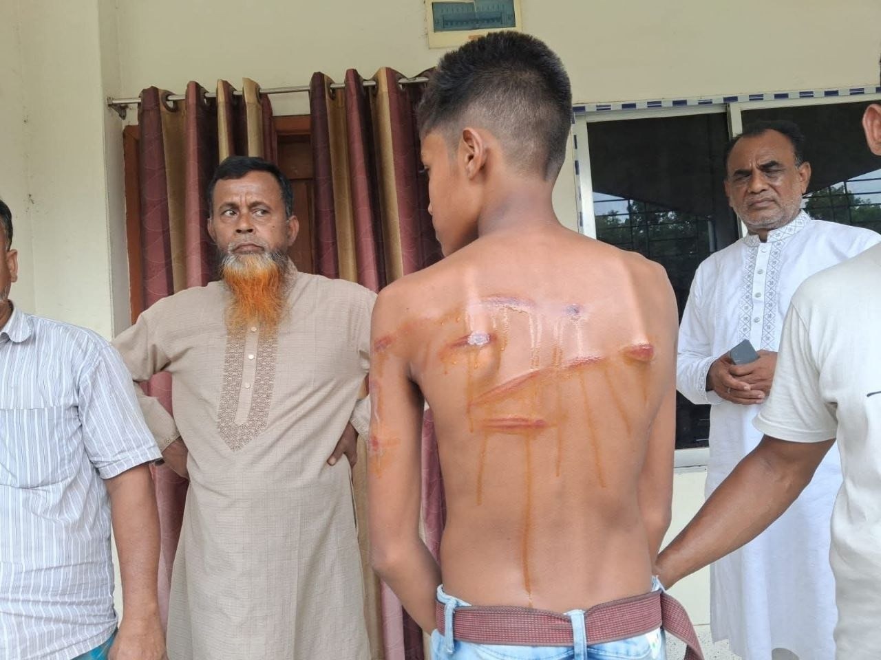 রাজবাড়ীর পাংশায় শিক্ষকের বেত্রাঘাতে হাসপাতালে ছাত্র, অবরুদ্ধ শিক্ষক